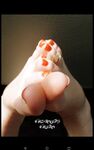 Twisted Toes feet